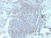 IHC staining of FFPE human lymph node tissue with HOMEZ antibody (clone PCRP-HOMEZ-1A5). HIER: boil tissue sections in pH 9 10mM Tris with 1mM EDTA for 20 min and allow to cool before testing.