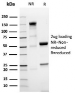 SDS-PAGE analysis of purified, BSA-free NKX3.1 antibody (NKX3.1/4562R) as confirmation of integrity and purity.