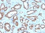 IHC staining of FFPE human prostate tissue with NKX3.1 antibody (clone NKX3.1/4562R). HIER: boil tissue sections in pH 9 10mM Tris with 1mM EDTA for 20 min and allow to cool before testing.