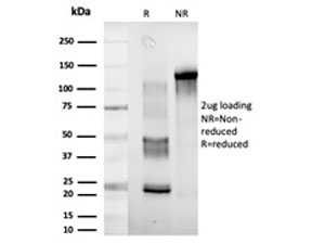 SDS-PAGE analysis of purified, BSA-free DDX41 antibody (clone PCRP-DDX41-1B4) as confirmation of integrity and purity.