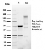 SDS-PAGE analysis of purified, BSA-free recombinant TMEPAI antibody (recombinant PMEPA1/6421R) as confirmation of integrity and purity.