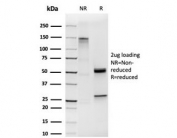 SDS-PAGE analysis of purified, BSA-free HOMEZ antibody (clone PCRP-HOMEZ-1B5) as confirmation of integrity and purity.