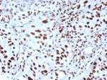 IHC staining of FFPE human bladder tissue with phospho-Histone H3 antibody (clone rPHH3/6824). HIER: boil tissue sections in pH 9 10mM Tris with 1mM EDTA for 20 min and allow to cool before testing.