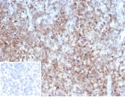 IHC staining of FFPE human tonsil tissue with CD2 antibody (clone LFA2/7102). Negative control inset: PBS instead of primary antibody to control for secondary binding. HIER: boil tissue sections in pH 9 10mM Tris with 1mM EDTA for 20 min and allow to cool before testing.