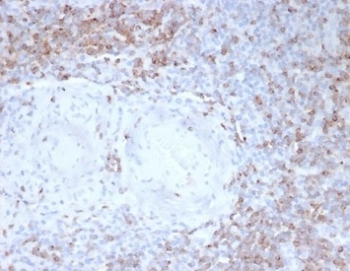 IHC staining of FFPE human tonsil tissue with C2 antibody (clone LFA2/7102) at 2ug/ml in PBS for 30min RT. Strong cell surface staining observed. HIER: boil tissue sections in pH 9 10mM Tris with 1mM EDTA for 20 min and allow to cool before testing.