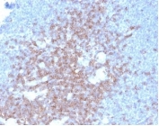 IHC staining of FFPE human lymph node tissue with CD2 antibody (clone LFA2/7102) at 2ug/ml in PBS for 30min RT. HIER: boil tissue sections in pH 9 10mM Tris with 1mM EDTA for 20 min and allow to cool before testing.