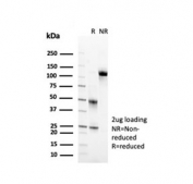 SDS-PAGE analysis of purified, BSA-free CD2 antibody (clone LFA2/7102) as confirmation of integrity and purity.