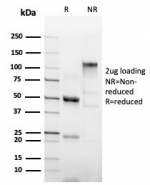 SDS-PAGE analysis of purified, BSA-free recombinant Poly His antibody (clone 6HIS/6402R) as confirmation of integrity and purity.