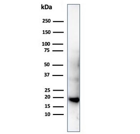 Western blot testing of His-tagged protein using recombinant Poly His antibody (clone 6HIS/6402R).~