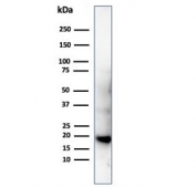 Western blot testing of His-tagged protein using recombinant Poly His antibody (clone 6HIS/6402R).