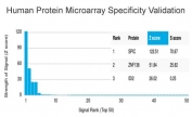 Analysis of HuProt(TM) microarray containing more than 19,000 full-length human proteins using SPIC antibody (clone PCRP-SPIC-2C5). These results demonstrate the foremost specificity of the PCRP-SPIC-2C5 mAb. Z- and S- score: The Z-score represents the strength of a signal that an antibody (in combination with a fluorescently-tagged anti-IgG secondary Ab) produces when binding to a particular protein on the HuProt(TM) array. Z-scores are described in units of standard deviations (SD's) above the mean value of all signals generated on that array. If the targets on the HuProt(TM) are arranged in descending order of the Z-score, the S-score is the difference (also in units of SD's) between the Z-scores. The S-score therefore represents the relative target specificity of an Ab to its intended target.