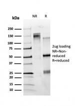 SDS-PAGE analysis of purified, BSA-free ZBTB7C antibody (PCRP-ZBTB7C-4E12) as confirmation of integrity and purity.
