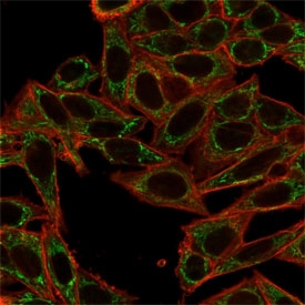 Immunofluorescent staining of PFA-fixed human HeLa cells using Sirtuin 2 antibody (green, clone PCRP-SIRT2-1A8) and phalloidin (red).