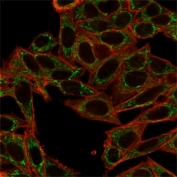 Immunofluorescent staining of PFA-fixed human HeLa cells using Sirtuin 2 antibody (green, clone PCRP-SIRT2-1A8) and phalloidin (red).