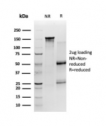 SDS-PAGE analysis of purified, BSA-free Sirtuin 2 antibody (clone PCRP-SIRT2-1A8) as confirmation of integrity and purity.