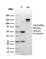 SDS-PAGE analysis of purified, BSA-free Th-Pok antibody (PCRP-ZBTB7B-1B6) as confirmation of integrity and purity.