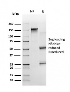 SDS-PAGE analysis of purified, BSA-free ZBTB7B antibody (PCRP-ZBTB7B-1F7) as confirmation of integrity and purity.