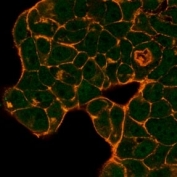 Immunofluorescent staining of PFA-fixed human MCF-7 cells using PRMT6 antibody (green, clone PCRP-PRMT6-2C9) and phalloidin (red).