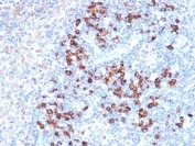 IHC staining of FFPE human lymph node tissue with ZFP64 antibody (clone PCRP-ZFP64-1H2). HIER: boil tissue sections in pH 9 10mM Tris with 1mM EDTA for 20 min and allow to cool before testing.