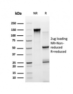 SDS-PAGE analysis of purified, BSA-free STAT5A antibody (PCRP-STAT5A-1A11) as confirmation of integrity and purity.