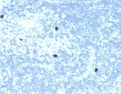 IHC staining of FFPE human lymph node tissue with RXRB antibody (clone PCRP-RXRB-2B6). HIER: boil tissue sections in pH 9 10mM Tris with 1mM EDTA for 20 min and allow to cool before testing.