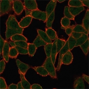 Immunofluorescent staining of human HeLa cells using SCXA antibody (green, clone PCRP-SCXA-2D11) and phalloidin (red).