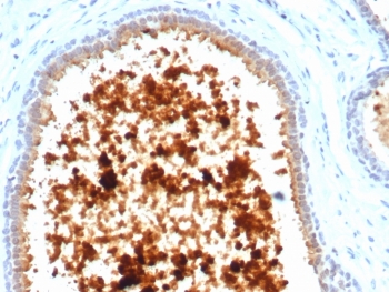 IHC staining of FFPE human lactating breast tissue with recombinant MGB1 antibody (clone MGB/4811R). HIER: boil tissue sections in pH 9 10mM Tris with 1mM EDTA for 20 min and allow to cool before testing.