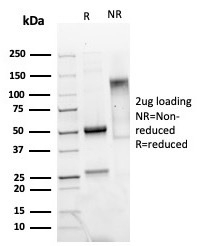 SDS-PAGE analysis of purified, BSA-free recombinant MGB1 antibody (clone MGB/4811R) as confirmation of integrity and purity.