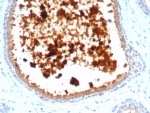 IHC staining of FFPE human lactating breast tissue with recombinant MGB1 antibody (clone MGB/4811R). HIER: boil tissue sections in pH 9 10mM Tris with 1mM EDTA for 20 min and allow to cool before testing.