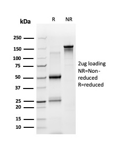 SDS-PAGE analysis of purified, BSA-free STAT5A antibody (PCRP-STAT5A-1A9) as confirmation of integrity and purity.