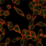 Immunofluorescent staining of PFA-fixed human HeLa cells using Ubiquitin-protein ligase E3A antibody (green, clone PCRP-UBE3A-1A2) and phalloidin (red).