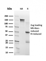 SDS-PAGE analysis of purified, BSA-free RHOXF2 antibody (clone PCRP-RHOXF2-1D7) as confirmation of integrity and purity.