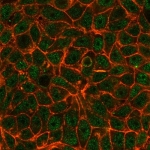 Immunofluorescent staining of PFA-fixed MCF7 cells using TIF1 alpha antibody (green, clone PCRP-TRIM24-1B12) and phalloidin (red).