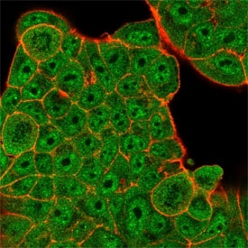Immunofluorescent staining of PFA-fixed human MCF-7 cells using ZBED1 antibody (green, clone PCRP-ZBED1-1E1) and phalloidin (red).