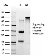 SDS-PAGE analysis of purified, BSA-free SET antibody (clone PCRP-SET-1C6) as confirmation of integrity and purity.