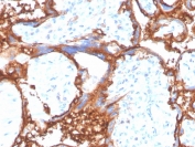 IHC staining of FFPE human placental tissue with EGF Receptor antibody (clone EGFR/4575). HIER: boil tissue sections in pH 9 10mM Tris with 1mM EDTA for 20 min and allow to cool before testing.