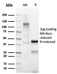 SDS-PAGE analysis of purified, BSA-free recombinant SCGB2A2 antibody (clone MGB/4812R) as confirmation of integrity and purity.