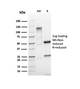 SDS-PAGE analysis of purified, BSA-free recombinant Ki-67 antibody (clone MKI67/4945R) as confirmation of integrity and purity.