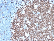 IHC staining of FFPE human tonsil tissue with recombinant Ki-67 antibody (clone MKI67/4945R). HIER: boil tissue sections in pH 9 10mM Tris with 1mM EDTA for 20 min and allow to cool before testing.