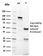 SDS-PAGE analysis of purified, BSA-free recombinant PAX5 antibody (clone PAX5/3977R) as confirmation of integrity and purity.