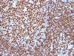 IHC staining of FFPE human tonsil tissue with recombinant PAX5 antibody (clone PAX5/3977R). HIER: boil tissue sections in pH 9 10mM Tris with 1mM EDTA for 20 min and allow to cool before testing.