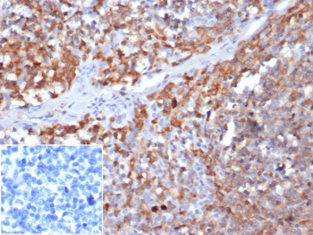IHC staining of FFPE human tonsil tissue with Gamma Parvin antibody (clone 8C5.2) at 2ug/ml in PBS. Negative control inset: PBS instead of primary antibody to control for secondary binding. HIER: boil tissue sections in pH 9 10mM Tris with 1mM EDTA for 20 min and allow to cool before testing.~