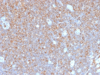 IHC staining of FFPE human tonsil tissue with recombinant PARVG antibody (clone PARVG/6312R). HIER: boil tissue sections in pH 9 10mM Tris with 1mM EDTA for 20 min and allow to cool before testing.