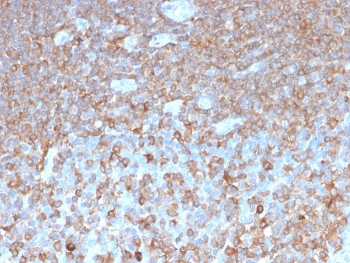 IHC staining of FFPE human tonsil tissue with recombinant PARVG antibody (clone PARVG/6312R). HIER: boil tissue sections in pH 9 10mM Tris with 1mM EDTA for 20 min and allow to cool before testing.