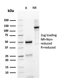 SDS-PAGE analysis of purified, BSA-free recombinant PARVG antibody (clone PARVG/6312R) as confirmation of integrity and purity.