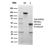 SDS-PAGE analysis of purified, BSA-free recombinant HSP60 antibody (clone rHSPD1/6495) as confirmation of integrity and purity.