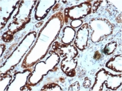 IHC staining of FFPE human thyroid tissue with recombinant HSP60 antibody (clone rHSPD1/6495). HIER: boil tissue sections in pH 9 10mM Tris with 1mM EDTA for 20 min and allow to cool before testing.