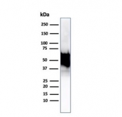 Western blot testing of human Hep2 cell lysate using recombinant HSP60 antibody (clone rHSPD1/6495). Predicted molecular weight: ~60 kDa.