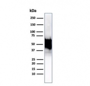 Western blot testing of human Hep2 cell lysate using recombinant HSP60 antibody (clone rHSPD1/6495). Predicted molecular weight: ~60 kDa.