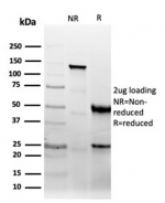 SDS-PAGE analysis of purified, BSA-free recombinant CD47 antibody (clone CD47/6364R) as confirmation of integrity and purity.